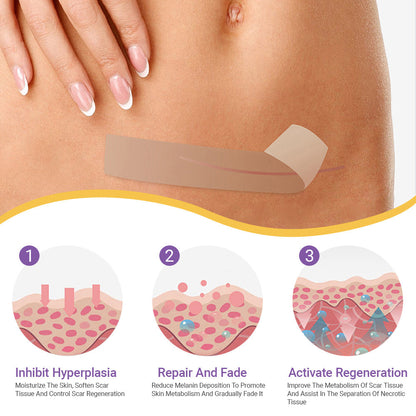 ✅Official Store |BBOJI® Hyaluronic Acid Nano Microneedle Repair Tape🏥(Treatment of old and new scars, reduction of surgical scars, stretch marks, keloids, acne, burns, warts, dermatomes and varicose veins)