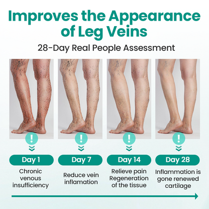 Erase Varicose Veins and Leg Pain Fast—Glowrizon® LegRenew Patch with 80% Off Today Only!