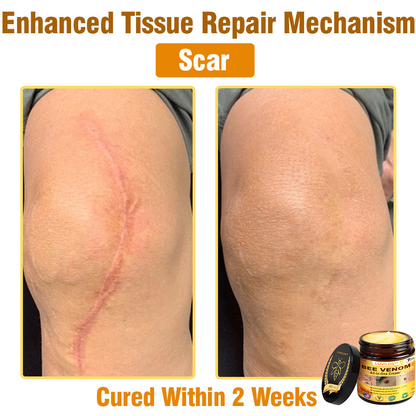 LOVILDS™ Bee Venom Cream – 🌸 Anti-Aging, Hydrating & Skin Repair